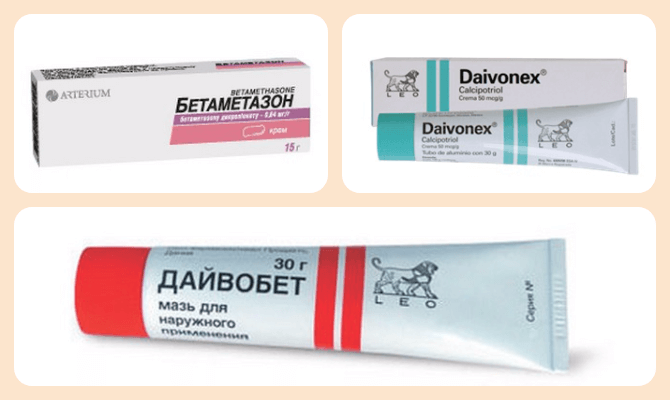 мази от псориаза на ногтях
