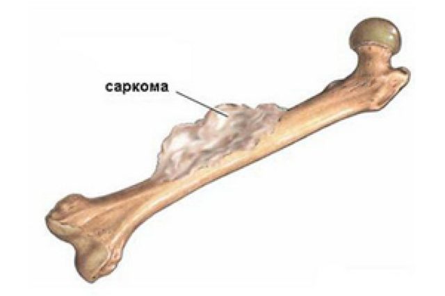 Боль на внутренней стороне бедра – причины и лечение
