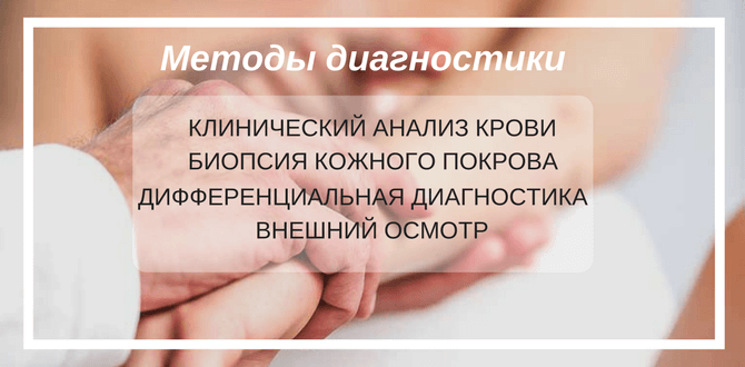 методы диагностика пустулезного псориаза
