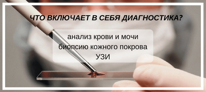 как диагностируют экссудативный псориаз