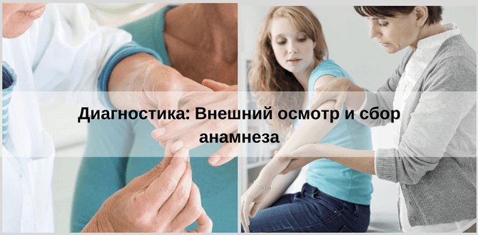 диагностика псориаза у женщин