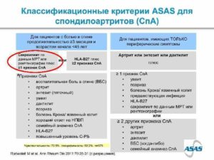 Периферический спондилоартрит лечение