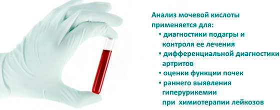 О чем говорят показатели содержания мочевой кислоты в крови?
