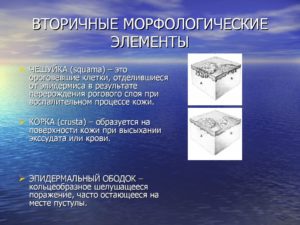 Вторичные элементы