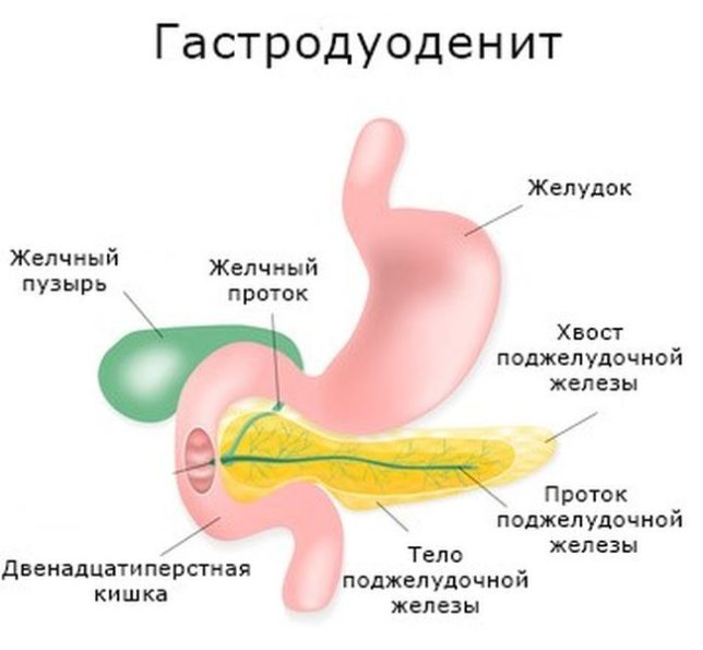Характеристика и особенности заболевания