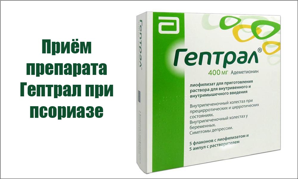Приём препарата Гептрал при псориазе