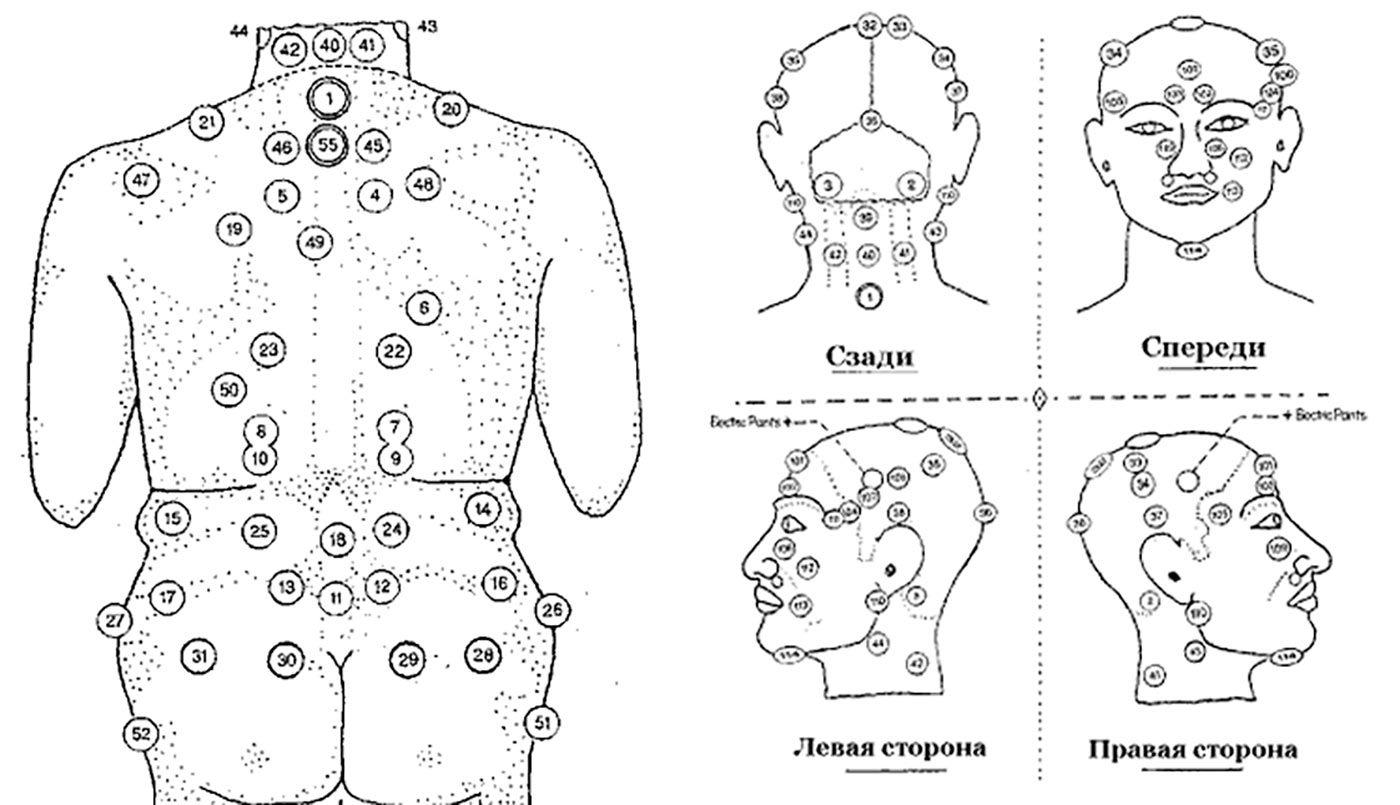 Главные точки хиджамы