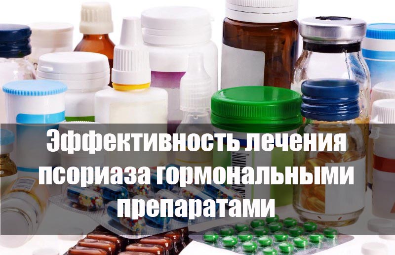 Эффективность лечения псориаза гормональными препаратами
