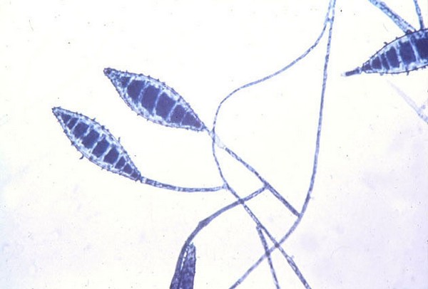 грибки рода Microsporum canis