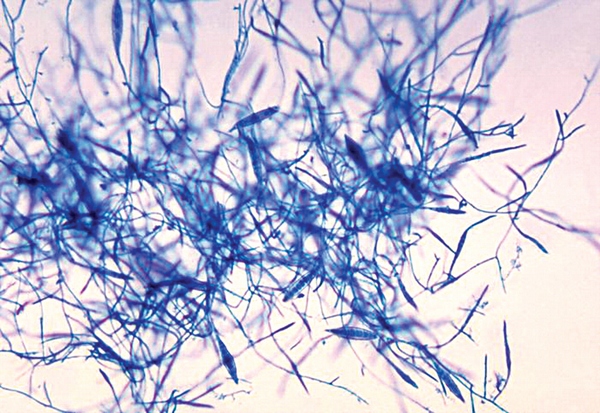 грибки рода Microsporum