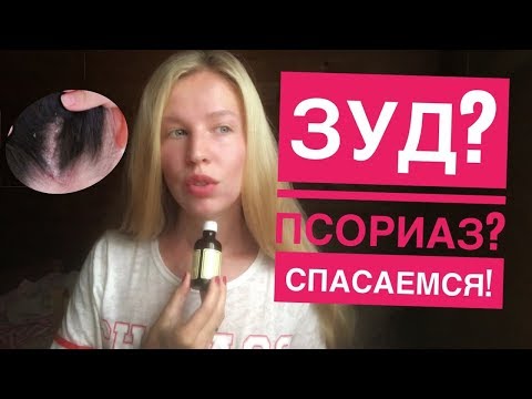 РУСЫ КОСЫ: НЕРВНЫЙ ПСОРИАЗ И КАК ЕГО ОДОЛЕТЬ