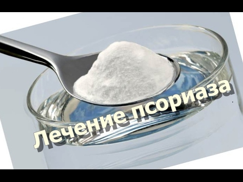 индийский лук лечебные свойства при псориазе