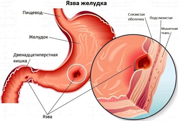Настойка гриба Веселка. Применение, инструкция, от каких болезней, польза, вред, как приготовить