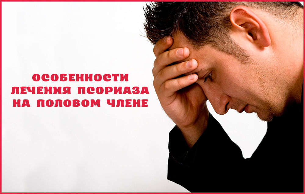 Как лечить псориаз на половом члене