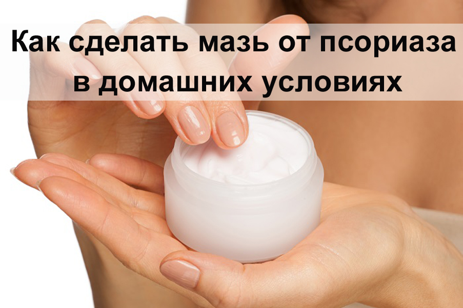 Как сделать мазь от псориаза в домашних условиях