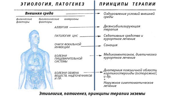 kak-vylechit-ekzemu