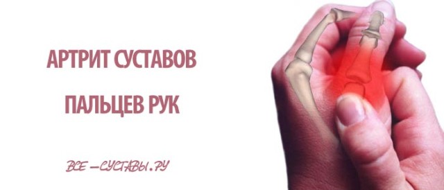 Распухли суставы на пальцах рук как лечить