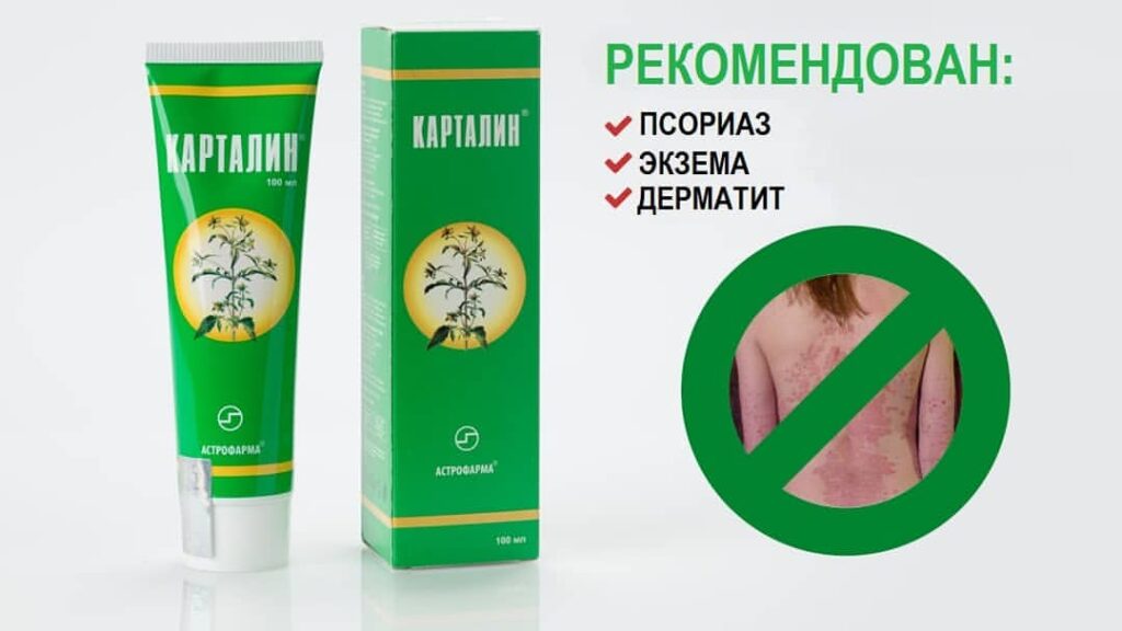 карталин рекомендован