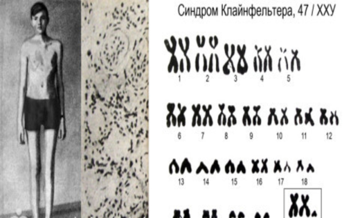 Какие бывают генетические заболевания