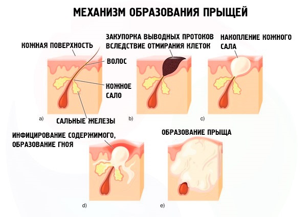 Крем Зорька. Инструкция по применению для людей от трещин на пятках, при варикозе, псориазе, пяточной шпоре, дерматите, экземе, геморрое