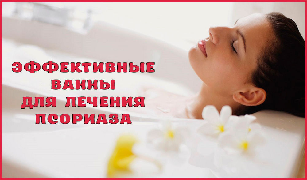 Лечебные ванны при псориазе