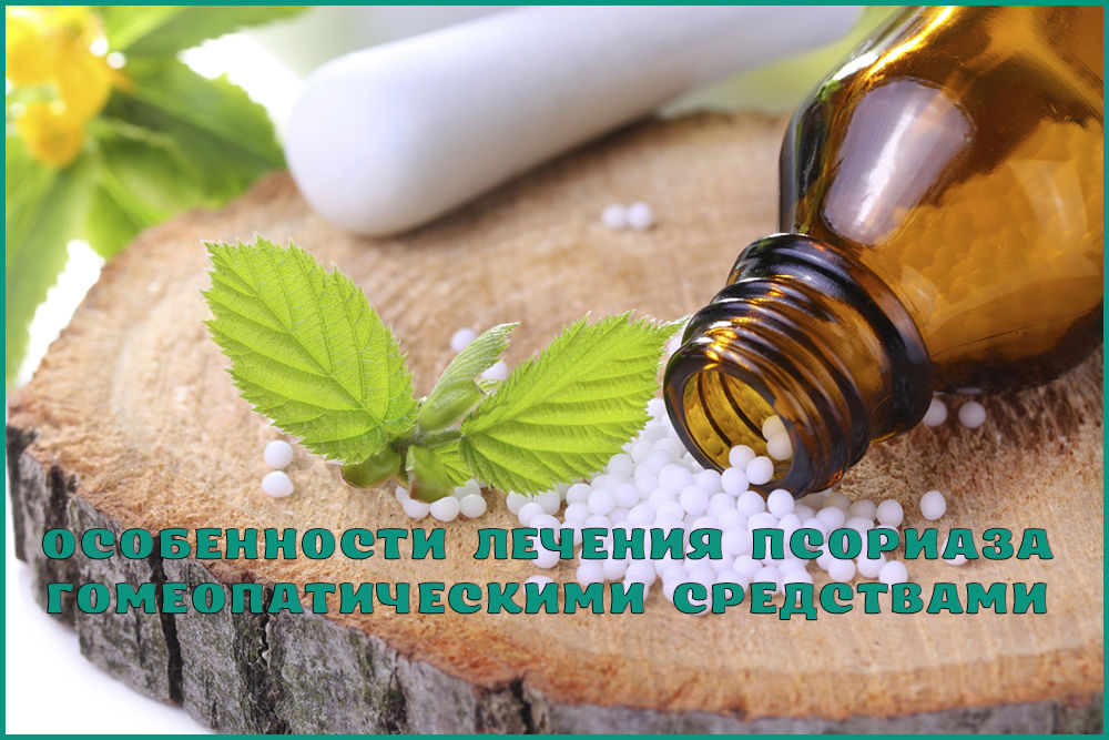 Лечение псориаза гомеопатией