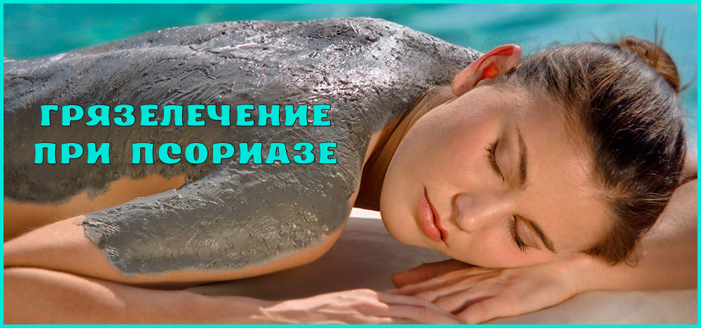 Лечение псориаза грязями