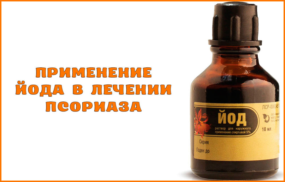 Лечение псориаза йодом