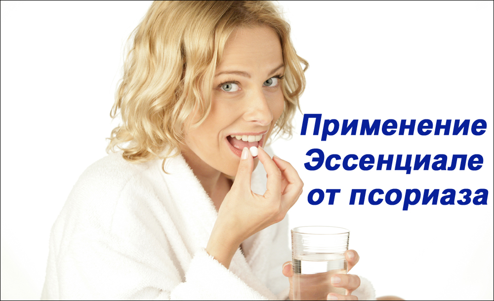 Лечение псориаза с помощью «Эссенциале»