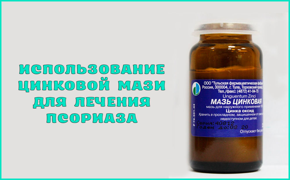 Лечение псориаза цинковой мазью