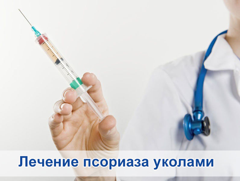 Лечение псориаза уколами
