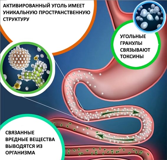 Лечение псориаза в домашних условиях активированным углем