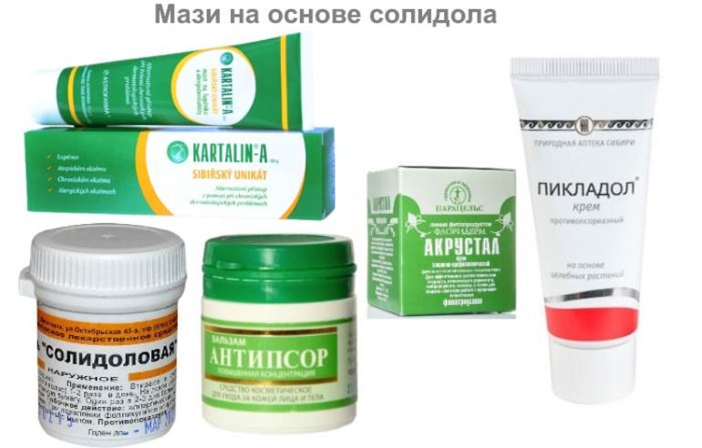  как лечить псориаз солидолом