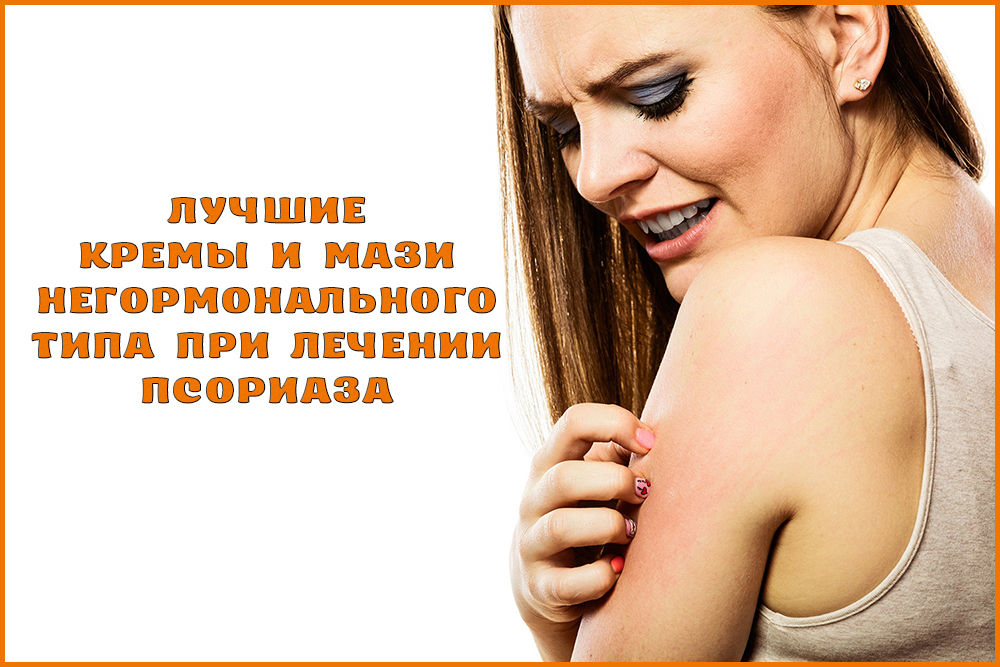 Лучшие негормональные мази и кремы от псориаза