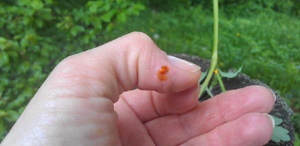 Масло чистотела. Свойства и применение при кожных и грибковых заболеваниях, в косметологии, гинекологии