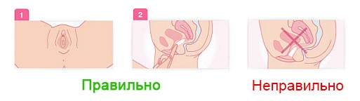 Масло чистотела. Свойства и применение при кожных и грибковых заболеваниях, в косметологии, гинекологии