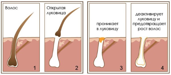 Масло чистотела. Свойства и применение при кожных и грибковых заболеваниях, в косметологии, гинекологии