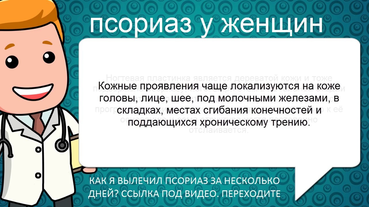 Первые признаки псориаза у женщин - YouTube