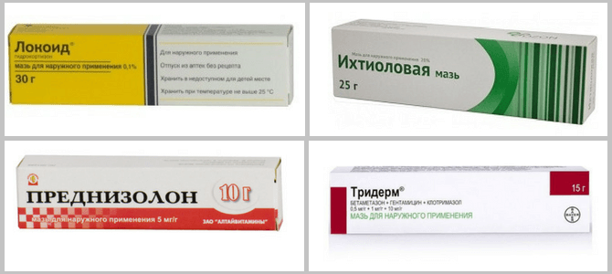 как лечить псориаз на руках