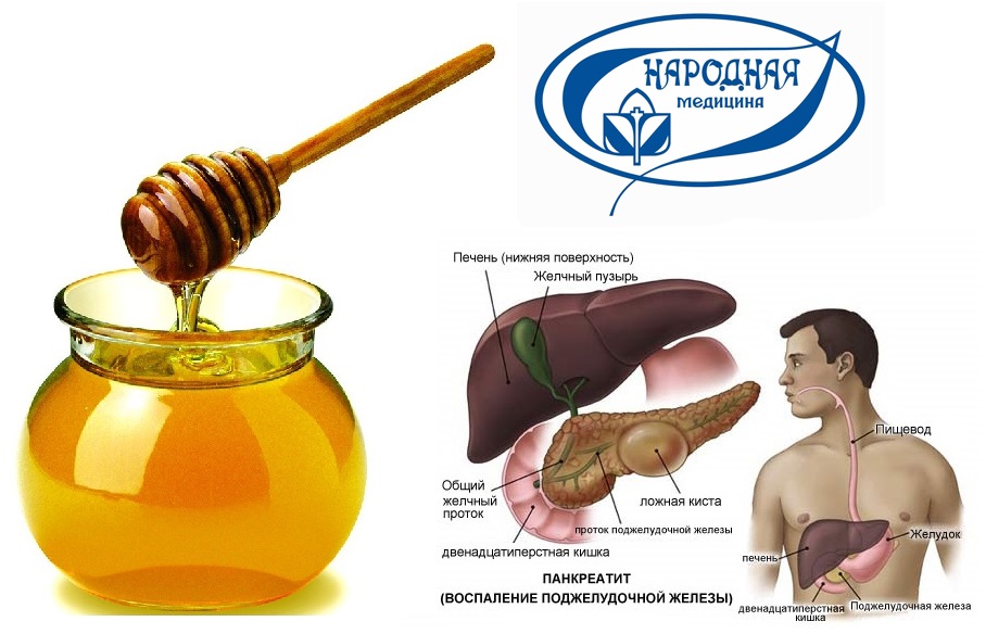 Мёд при панкреатите