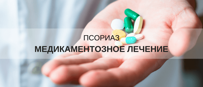 псориаз лечение мази и таблетки