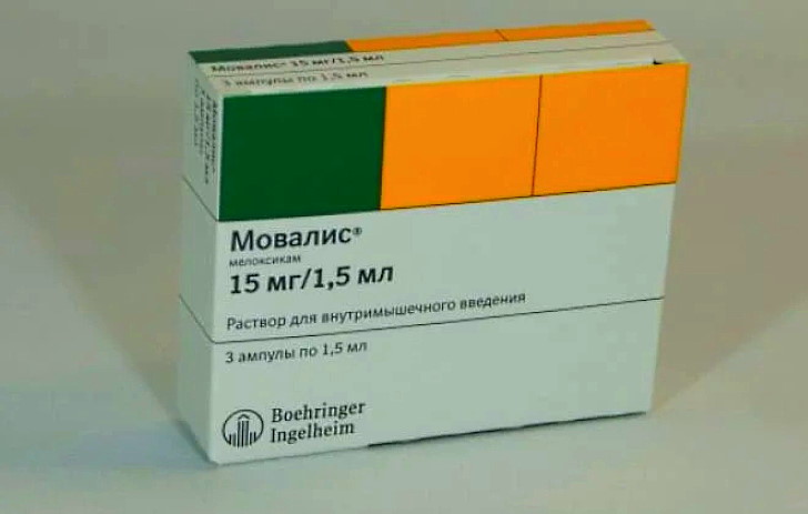 Лечение остеоартроза