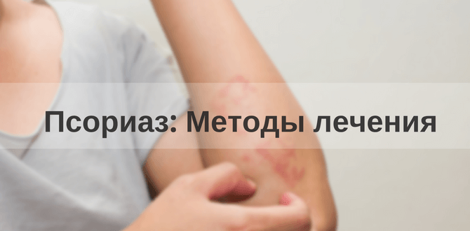Лечение псориаза: современные методы лечения псориаза