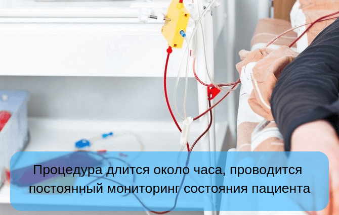 Методика проведения плазмафереза