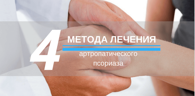 как лечить артропатический псориаз