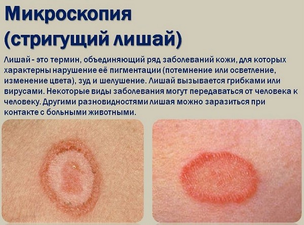 микроскопия