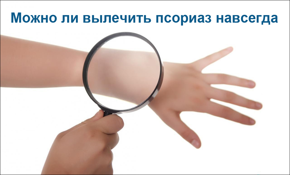 Можно ли вылечить псориаз навсегда