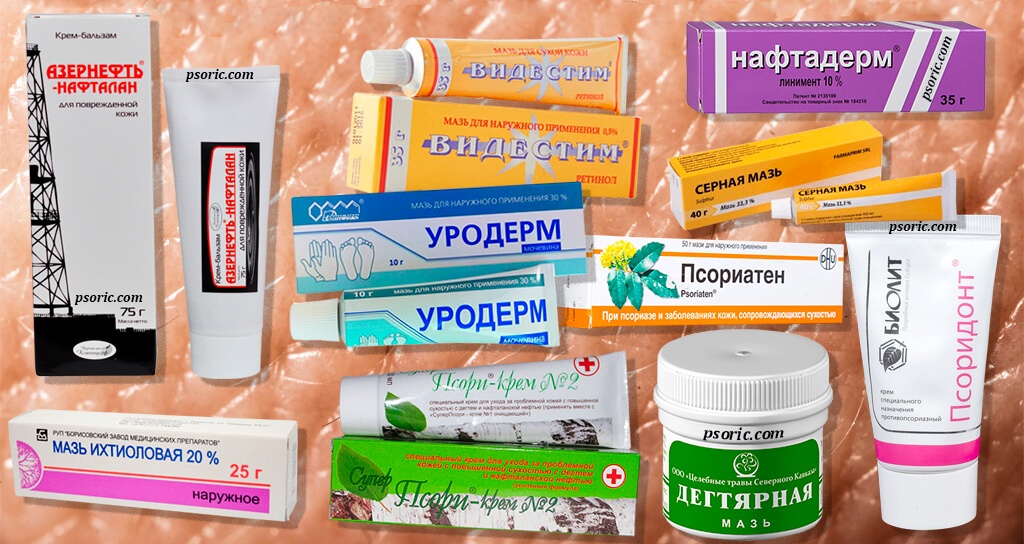 Тяжёлая форма хронического заболевания кожи - пустулёзный псориаз
