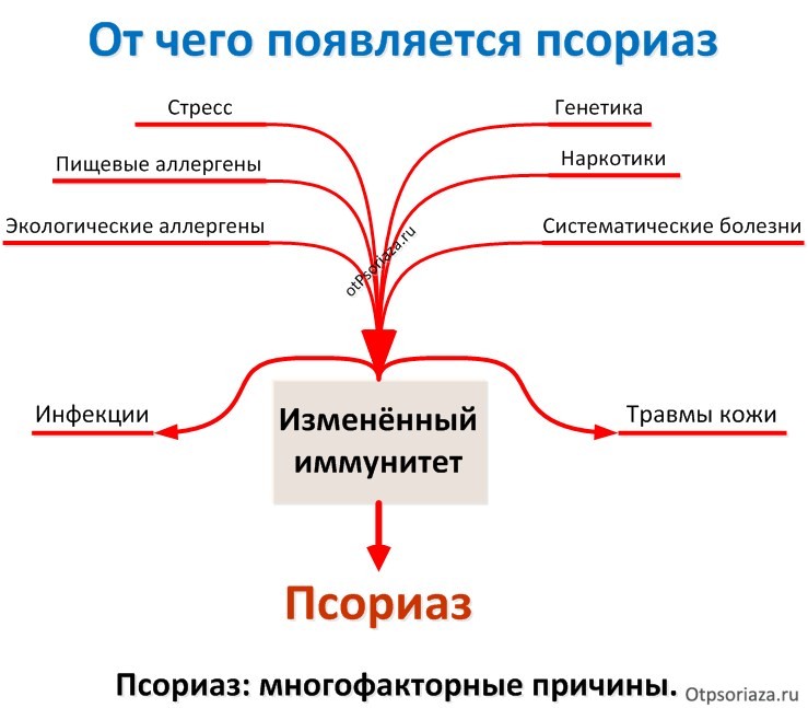 От чего появляется псориаз – причины возникновения