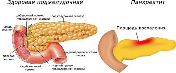 Озонотерапия внутривенно. Отзывы врачей, показания и противопоказания, польза и вред, курс лечения, можно ли проводить при беременности